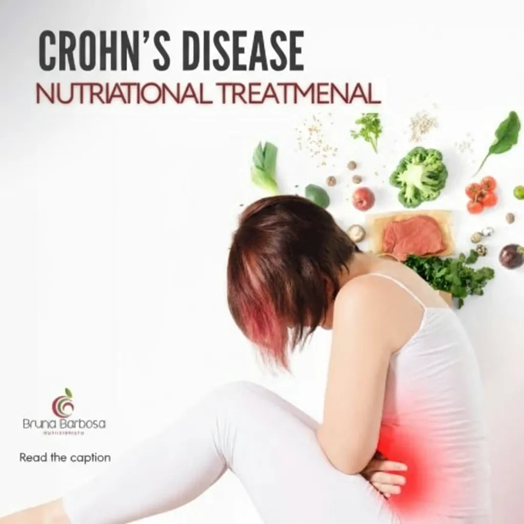 Crohn's Disease: Nutritional Treatment