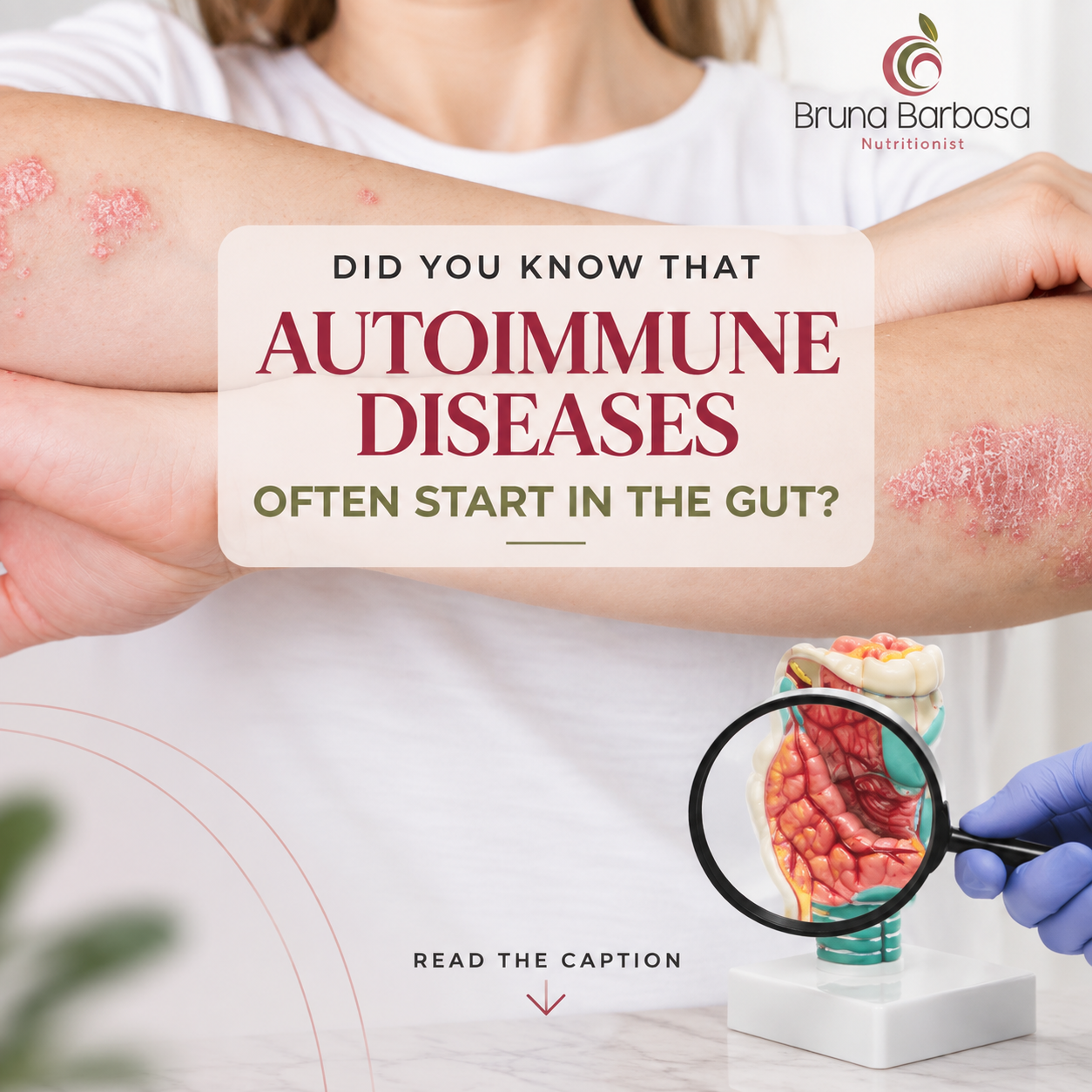 Autoimmune diseases begin in the Intestine